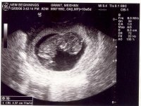 lil peanut 10w5d.jpg