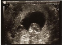 Baby scan 12 weeks.jpg