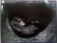10weeks0day.jpg