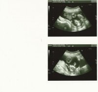 15wks 2days Scan both.jpg