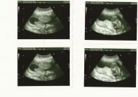 15wks 2days Scan LT RT.jpg