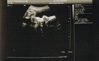 34 week scan[1].jpg