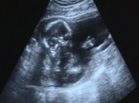 16wks scan (1).JPG