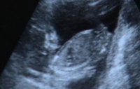 16wks scan (3).jpg