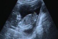 16wks scan (4).jpg