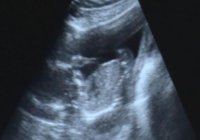 16wks scan (5).jpg