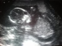 BabyHP 18+5.jpg