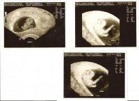 Baby 9weeks!).jpg