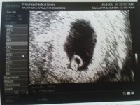 Scan at 6 weeks circle.JPG