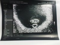 Scan at 7 weeks circle.JPG