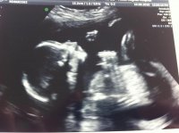 Baby Jesus 20+3.jpg