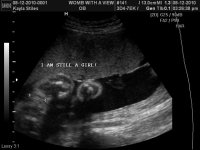 OUR LITTLE ONE_2.jpg
