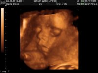 OUR LITTLE ONE_3.jpg