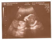 20 wk scan0001.jpg