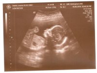 20 wk scan0002.jpg