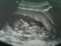 honeymoon party and baby 007.jpg