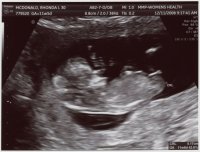 12 week scan.jpg