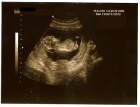 13 Weeks 1 Boy.JPG