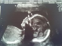 20wkscan1.jpg