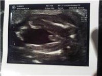 Baby Boy H 20+4.jpg