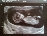 gemma scan.jpg