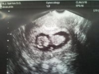 Baby 9-2-10.jpg