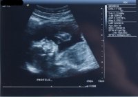 22wks3days036crop.jpg