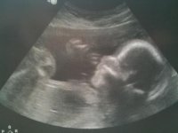 22 Week Scan.jpg