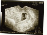 LastScan.jpg