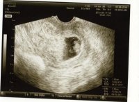 LastScan.jpg