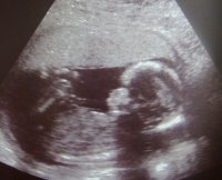 16w6d - Copy.jpg