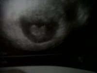 baby.jpg