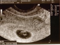 Our first ultrasound.jpg