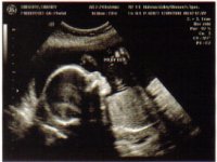 21 weeks 4 days.jpg