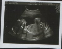 Scan20weeks.jpg