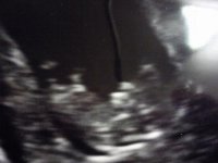 11 week scan.jpg