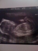 20 week scan.jpg
