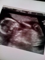 Baby Boy 20 week scan.jpg