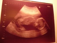 baby 2.jpg