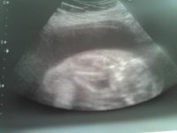 20 Weeks (3).jpg