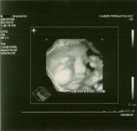 scan__1.jpg scan__1.jpg