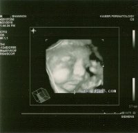 scan__3.jpg scan__3.jpg