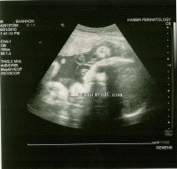 scan__4.jpg scan__4.jpg