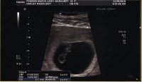 2ND SCAN 6 WEEKS 4 DAYS.jpg