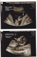 Sept 23 2010 13w2d pregnant.jpg