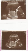 scan 20 wks.jpg