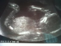 IMG00215-20100712-1241A.jpg