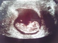 Button 1 weeks 2 days small.jpg