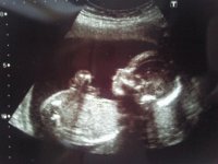 20 week scan.jpg