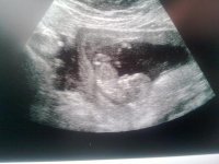 Baby @ 12 weeks 5 days.jpg